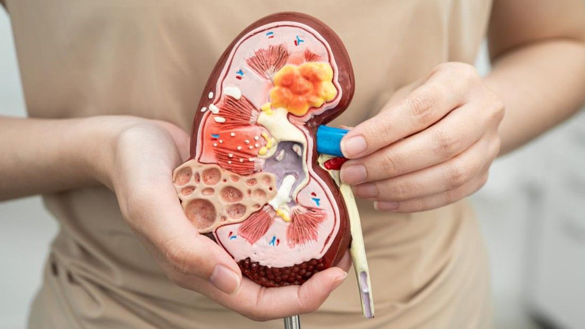 Konsumsi Natrium Berlebih Picu Tekanan Darah Tinggi dan Risiko Stroke