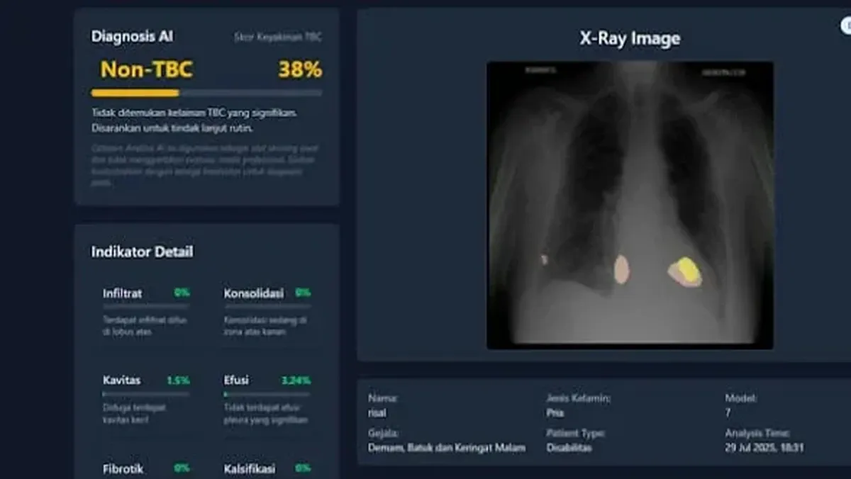 UGM Kembangkan Teknologi AI untuk Skrining Tuberkulosis di Wilayah 3T