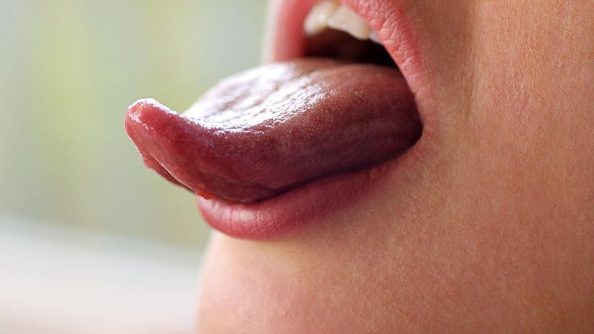 Perubahan Warna Lidah dan Bibir Tidak Selalu Tanda Kolesterol Tinggi