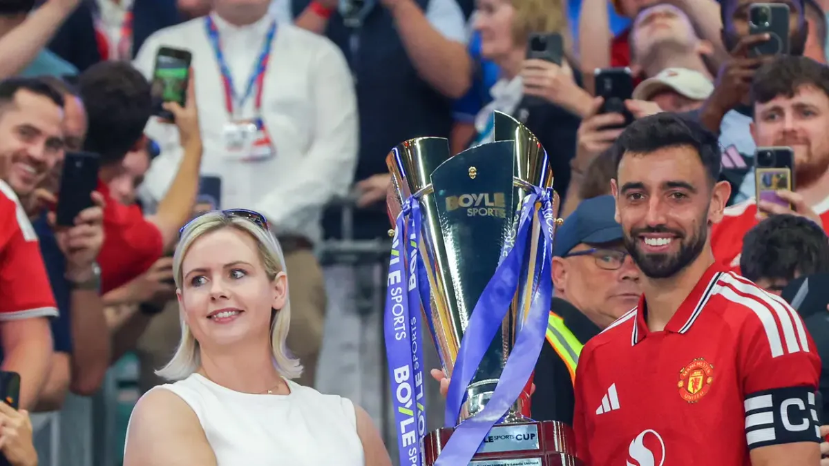 Manchester United Menang Adu Penalti atas Leeds United di Boyle Sports Cup