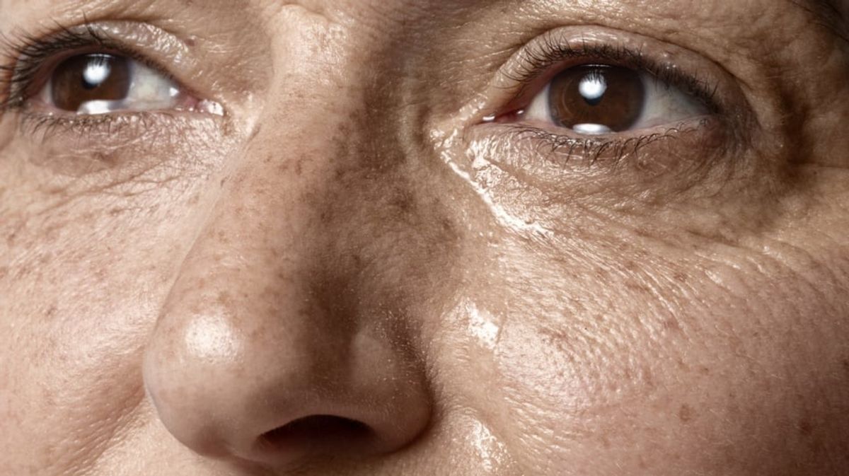 Kenali 7 Tanda Kulit Rusak Akibat Tidak Pakai Sunscreen Rutin